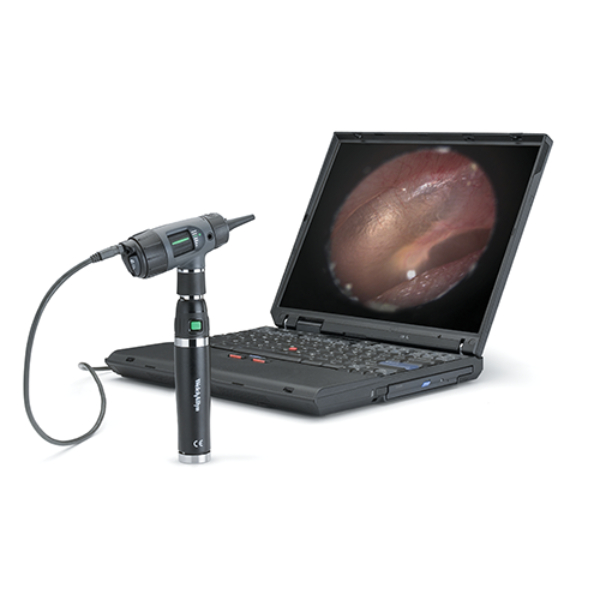 welch allyn digital macroview otoscoop